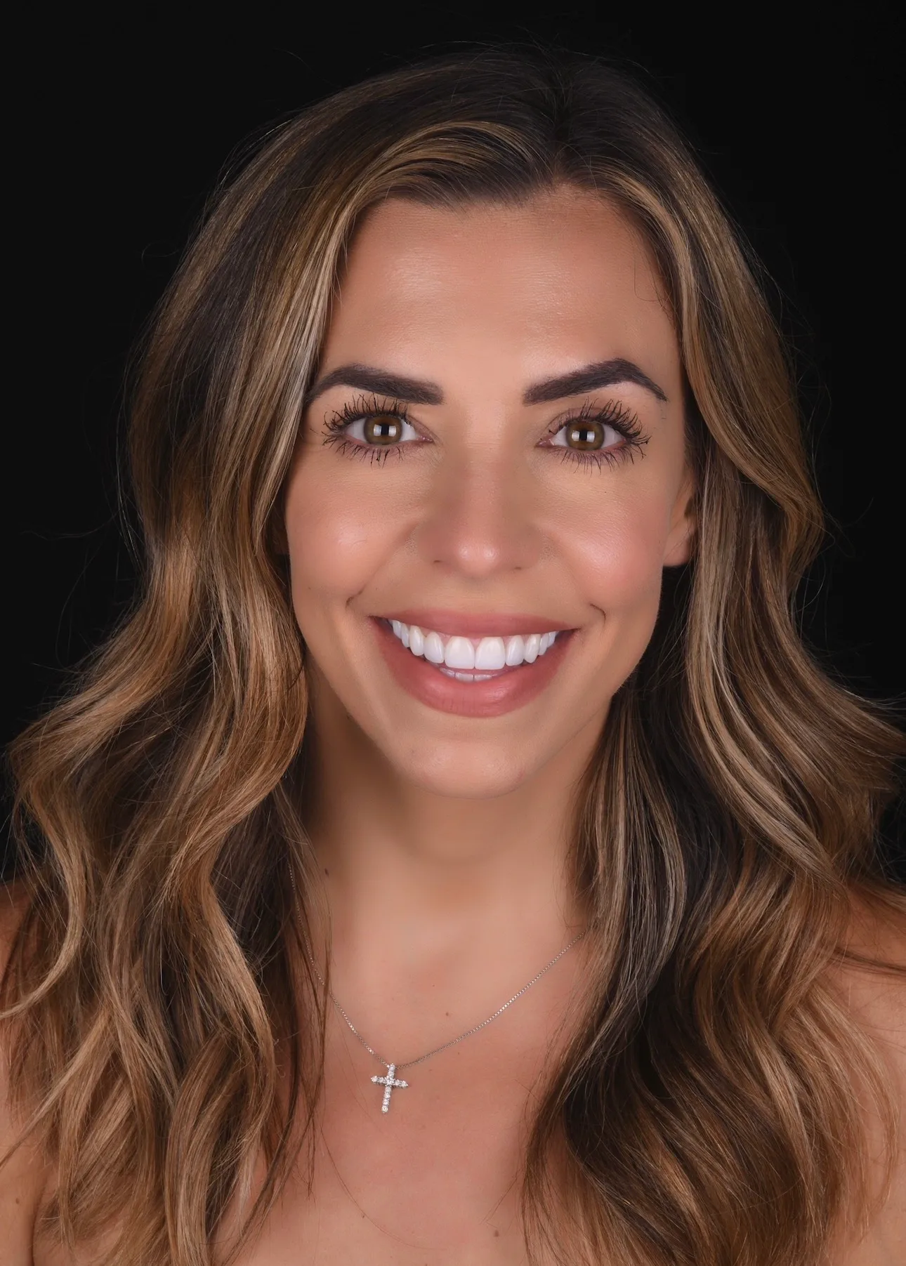 Full face after smile makeover patient two