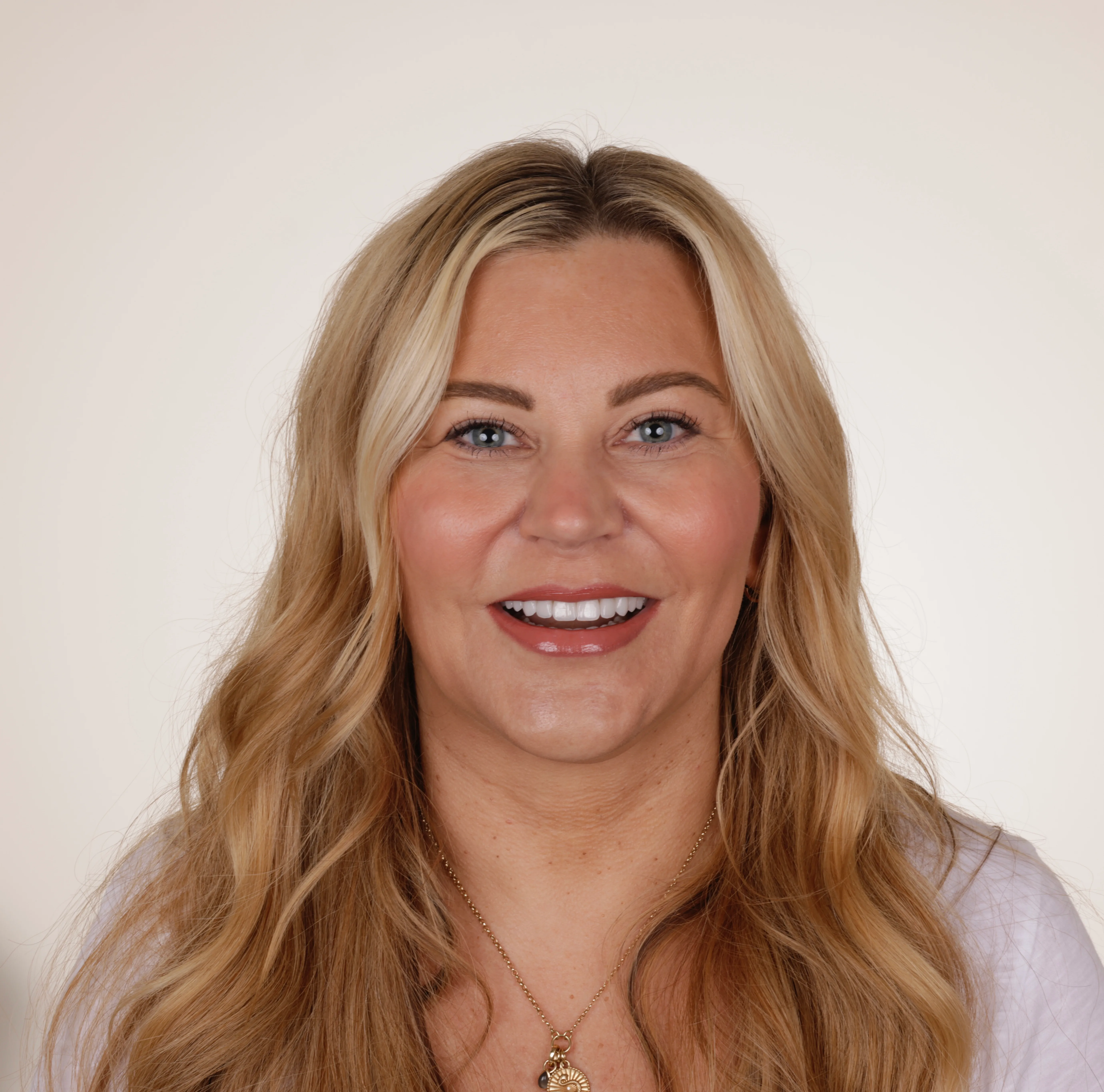 Full face after smile makeover patient three